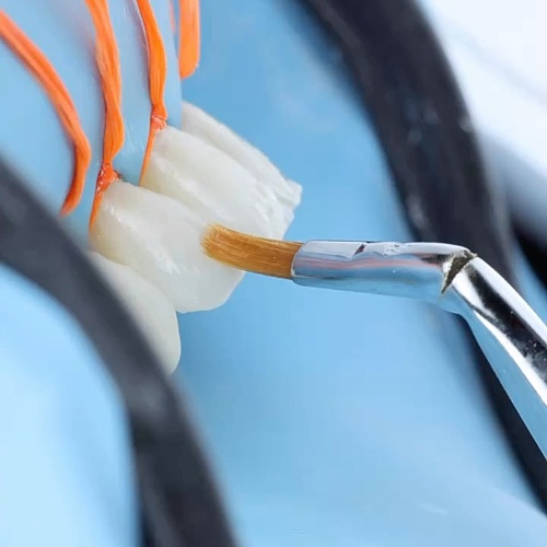 fast forward ⏩🩵🎨 align, bleach, bond … 🔥 #drkoeppen #dentistry #resin #zahnmedizin #zahnärztin #cosmeticdentistry...